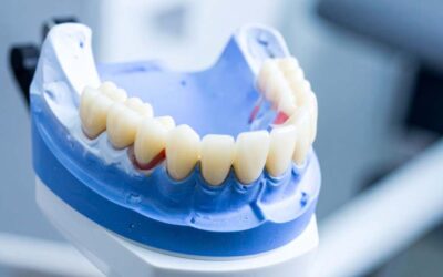¿Prótesis removible o fija? Guía para elegir tu pótesis dental según tu boca y presupuesto