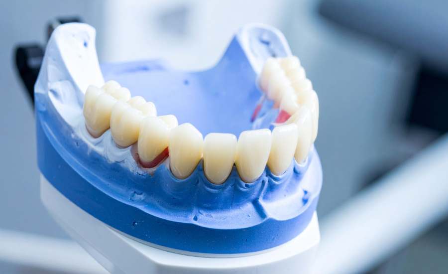 protesis-dental-min Prótesis dentales fijas y removibles para saber cuál elegir