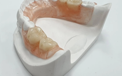 Prótesis Flexit: La alternativa ligera y estética a las dentaduras de la que todo el mundo habla.