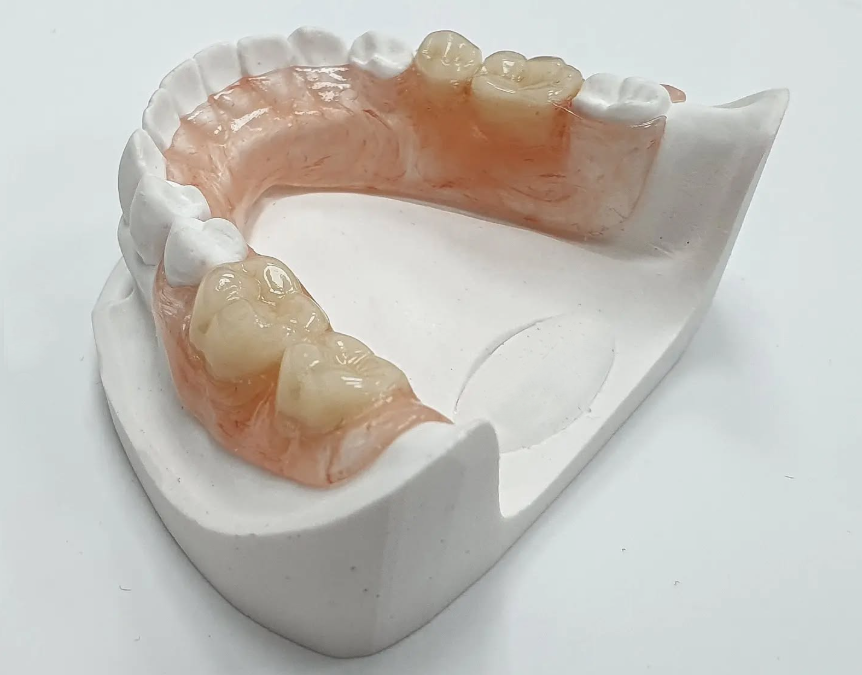 Prótesis Flexit: La alternativa ligera y estética a las dentaduras de la que todo el mundo habla.