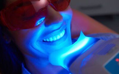 ¿Blanqueamiento dental sí o no?
