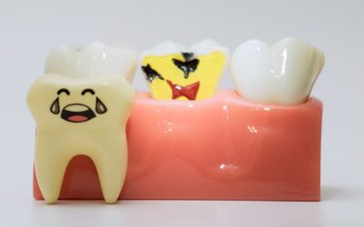 ¿Tu diente se está pudriendo por dentro sin que lo sepas? Todo sobre las caries dentales